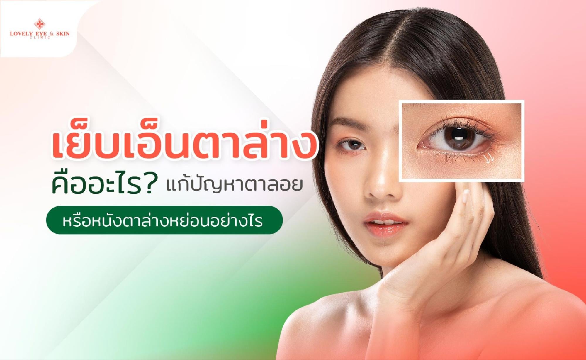 เย็บเอ็นตาล่าง