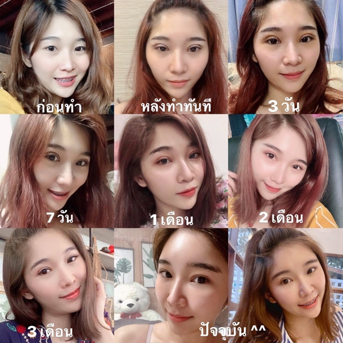 ทำตาสองชั้น