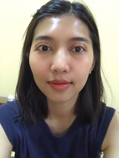 ทำตาสองชั้น เปิดหัวตา หนังตาตก