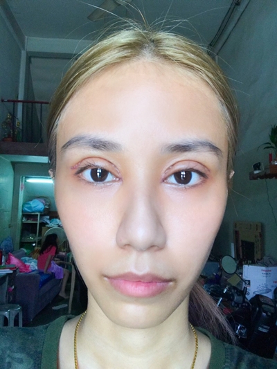 แก้ตาสองชั้น หมอรวงข้าว