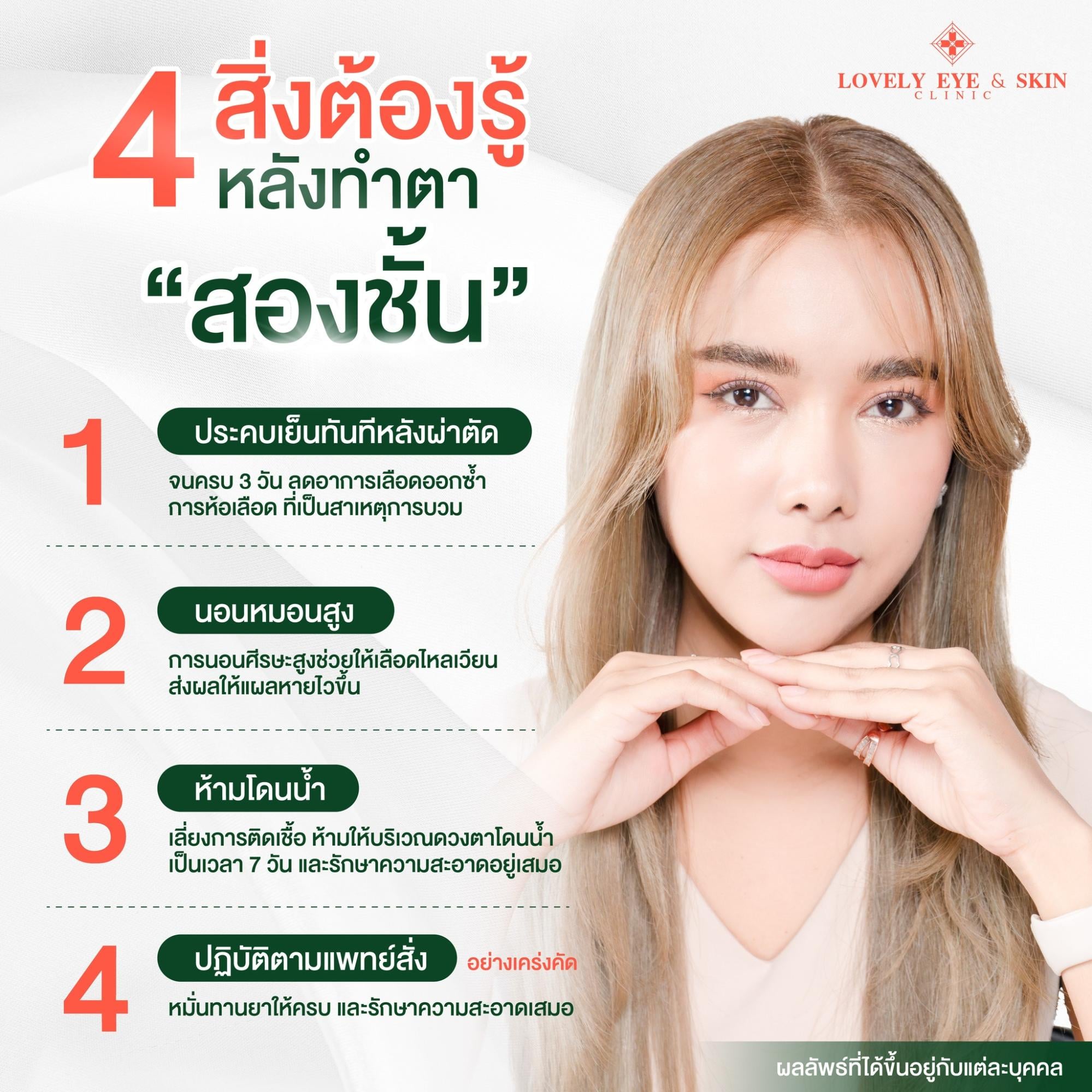 ดูแลตัวเอง หลังทำตา 2 ชั้น