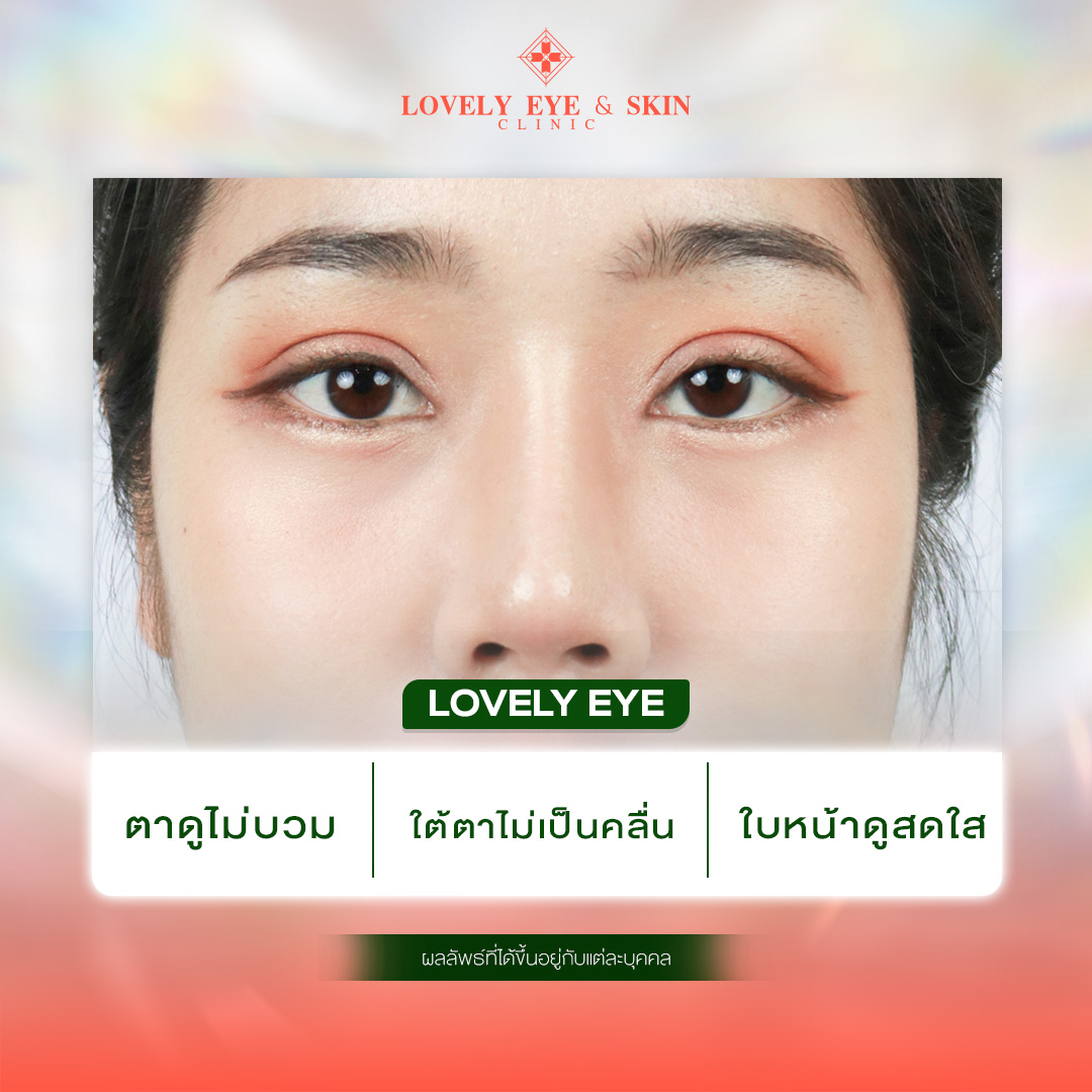 เทคโนโลยีช่วยให้การผ่าตัดถุงใต้ตาง่ายขึ้น