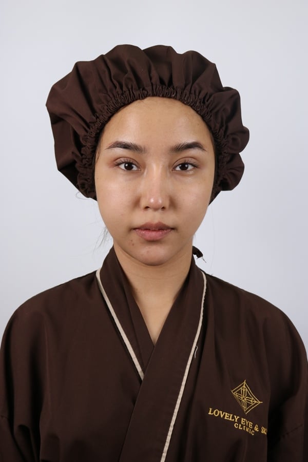 ตัดถุงใต้ตา 22.9 (13).JPG