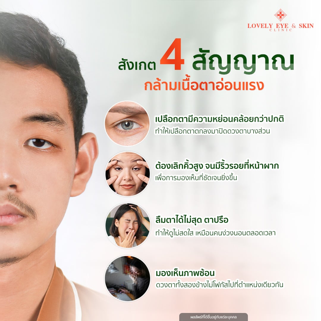 ตาปรือ