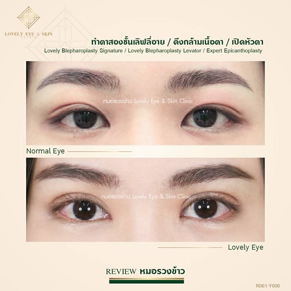 ตาล้า (1)_0.jpg