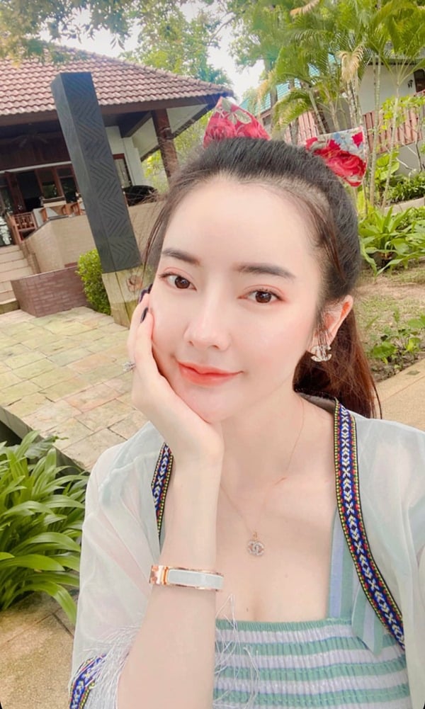 ทำตาสองชั้น ดึงกล้ามเนื้อตา 19_5_23 (1).jpg