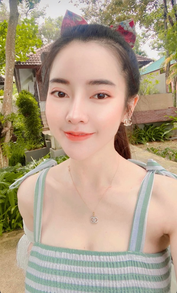 ทำตาสองชั้น ดึงกล้ามเนื้อตา 19_5_23 (11).jpg