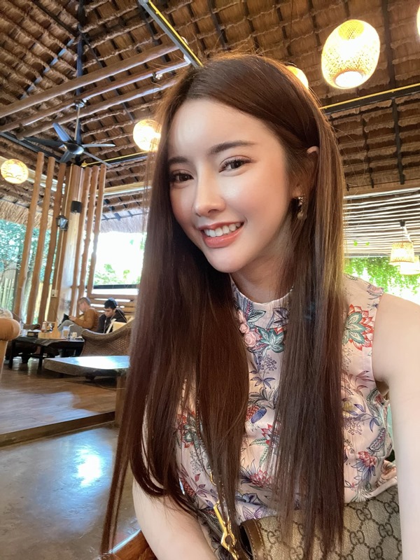 ทำตาสองชั้น ดึงกล้ามเนื้อตา 19_5_23 (3).jpg