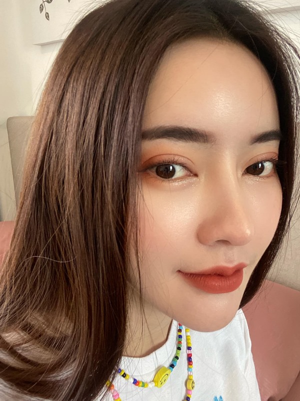 ทำตาสองชั้น ดึงกล้ามเนื้อตา 19_5_23 (4).jpg