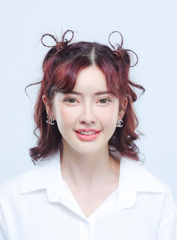 ทำตาสองชั้น ดึงกล้ามเนื้อตา 19_5_23 (8).jpg