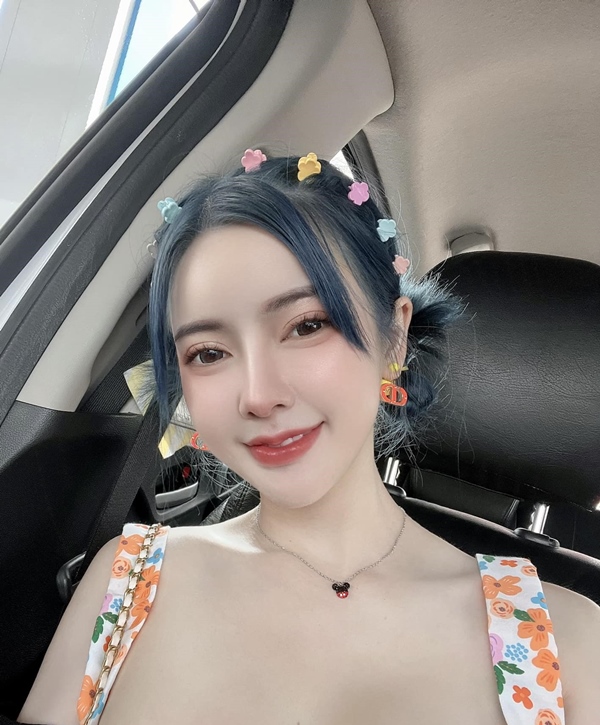 ทำตาสองชั้น ดึงกล้ามเนื้อตา 19_6_23 (1).jpg