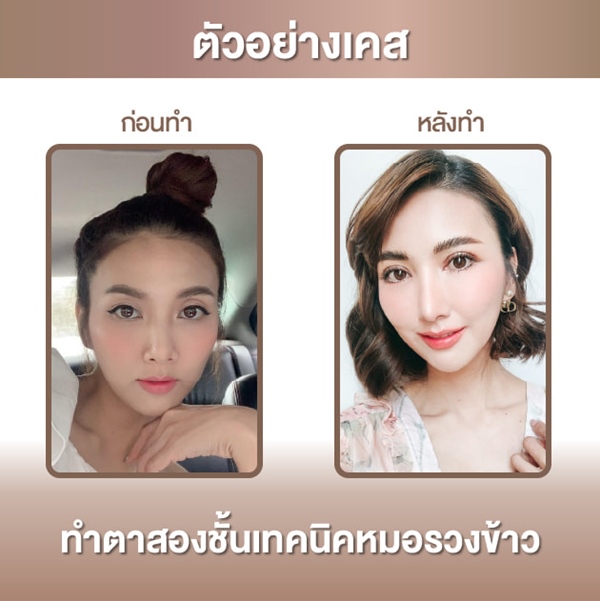 ทำตาสองชั้น หมอรวงข้าว akeru (6).jpg