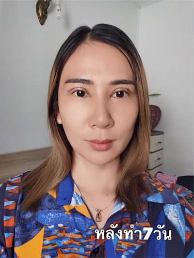 ทำตาสองชั้น เทคนิคหมอรวงข้าว 11 (2).jpg
