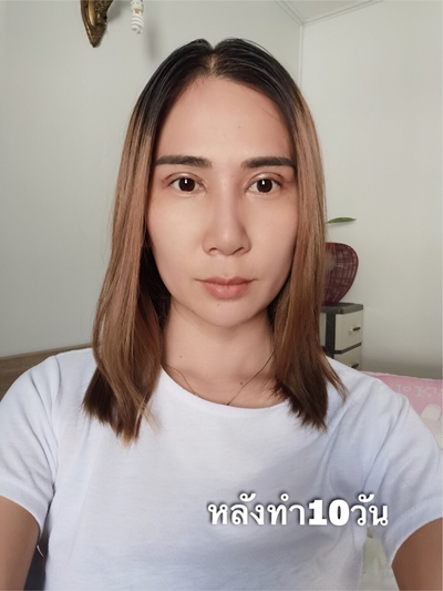 ทำตาสองชั้น เทคนิคหมอรวงข้าว 11 (3).jpg