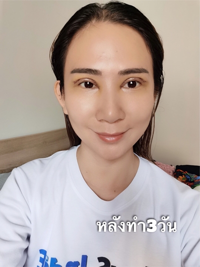ทำตาสองชั้น เทคนิคหมอรวงข้าว 11 (4).jpg