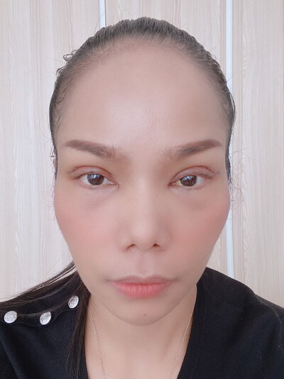 ทำตาสองชั้น เทคนิคหมอรวงข้าว 13 (5).jpg