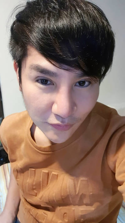 หลังทำตาสองชั้น 2 เดือน ชั้นตาเข้าที่ เป็นธรรมชาติมากขึ้น