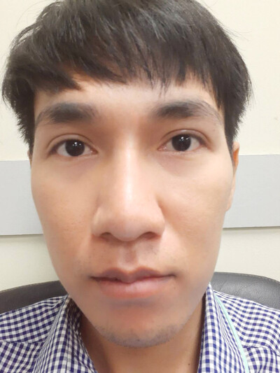 ยกหางตาซ่อนแผลใต้คิ้ว เทคนิคหมอรวงข้าว 2 (45).jpg
