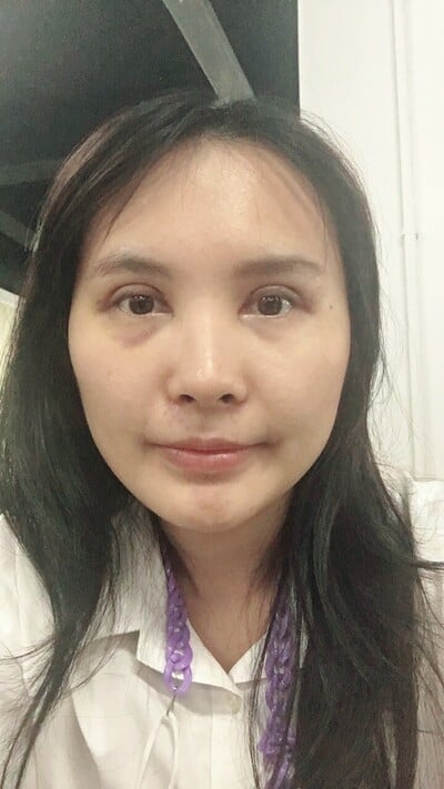 ทำตาสองชั้น เทคนิคหมอรวงข้าว 25.jpg