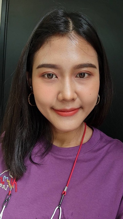 หลังทำตาสองชั้น เปิดหัวตา 3 เดือน