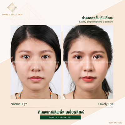 ทำตาสองชั้น เทคนิคหมอรวงข้าว 44 (1).jpg