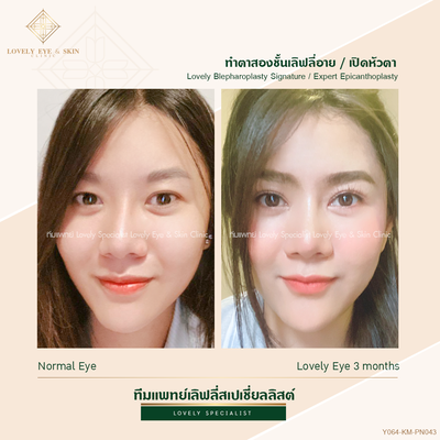 ทำตาสองชั้น เทคนิคหมอรวงข้าว 44 (1).png