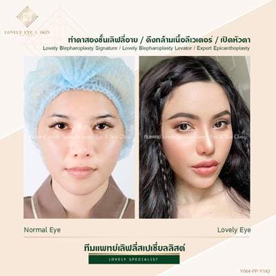 ทำตาสองชั้น เทคนิคหมอรวงข้าว 46 (2).jpg