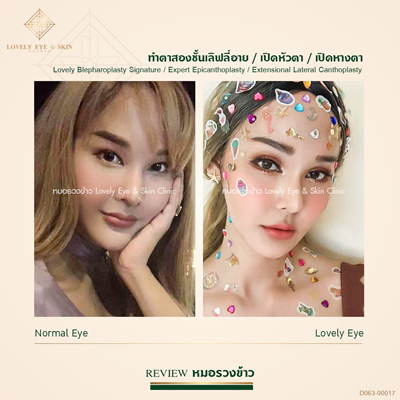 ทำตาสองชั้น เทคนิคหมอรวงข้าว 46 (2).png