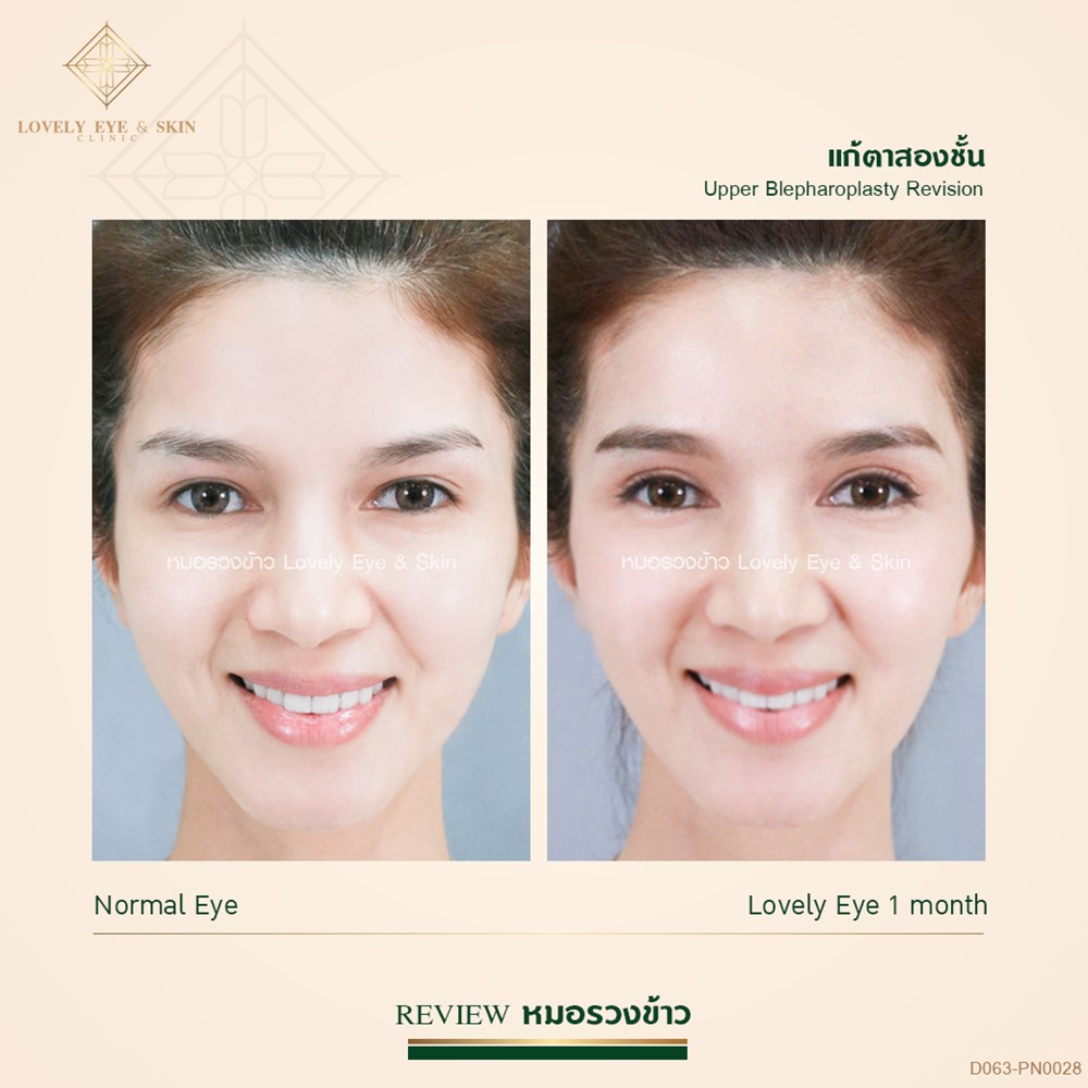 ทำตาสองชั้น เทคนิคหมอรวงข้าว 56 (7).jpg