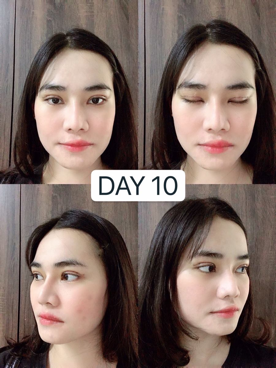 ทำตาสองชั้น เทคนิคหมอรวงข้าว 60 (5).jpg