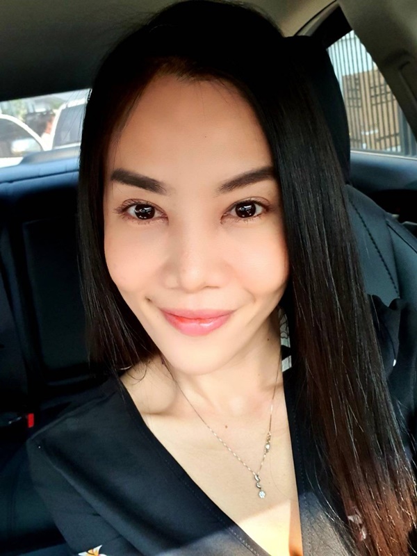 หลังทําตาสองชั้น+เปิดหัวตา+ดึงกล้ามเนื้อตาLevator+เติมไขมัน 3 เดือน ชั้นตาดูเป็นธรรมชาติ