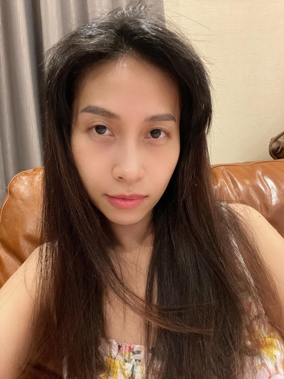 ทำตาสองชั้น เปิดหัวตา ดึงกล้ามเนื้อตา เติมไขมันตา 1 (4).jpg