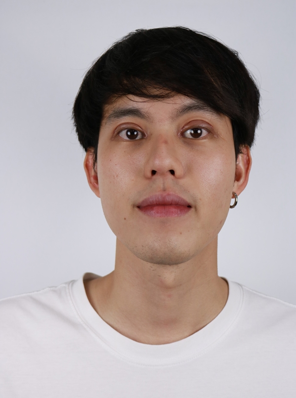 ทำตาสองชั้น เปิดหัวตา ดึงกล้ามเนื้อตาLevator เติมไขมัน 16_6_23 (1)_0.jpg