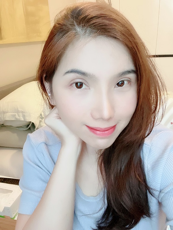 หลังทำตาสองชั้น+เปิดหัวตา+เปิดหางตา 3 เดือน ชั้นตาดูเข้าที่ เป็นธรรมชาติ