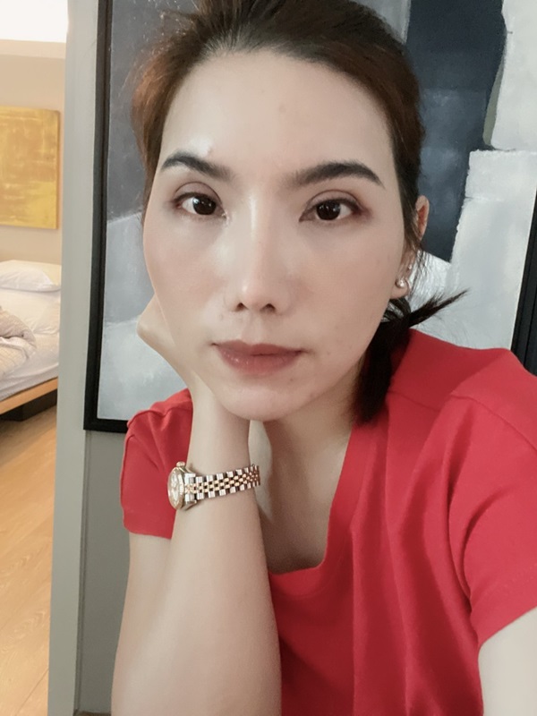 หลังทำตาสองชั้น+เปิดหัวตา+เปิดหางตา 1 เดือน ตาเรียวยาว ชั้นตาชัด