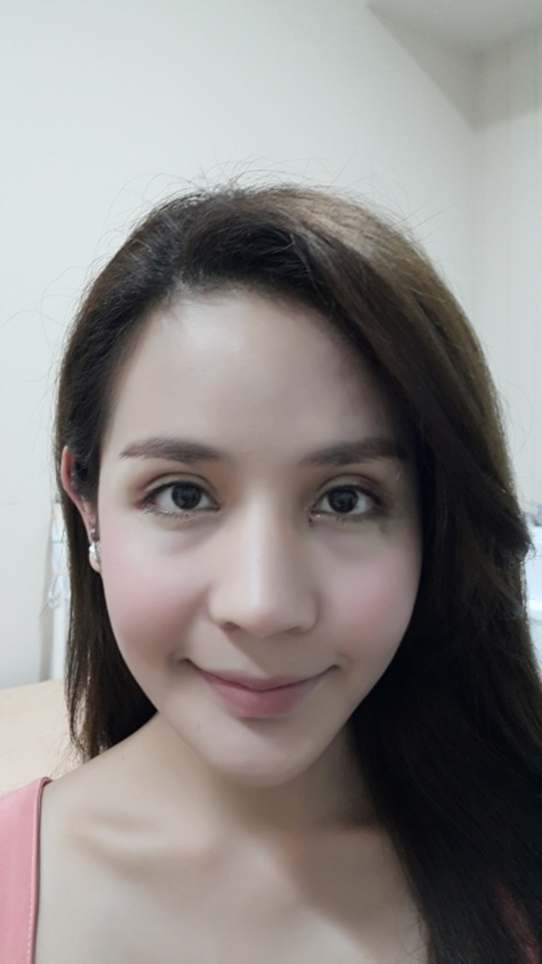 ทำตาสองชั้น เปิดหัวตา เปิดหางตา 30_6_23 (6).jpg
