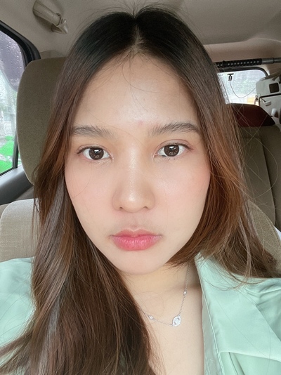 ปัญหาตาสองชั้นหลบใน และไขมันหนังตาเยอะ
