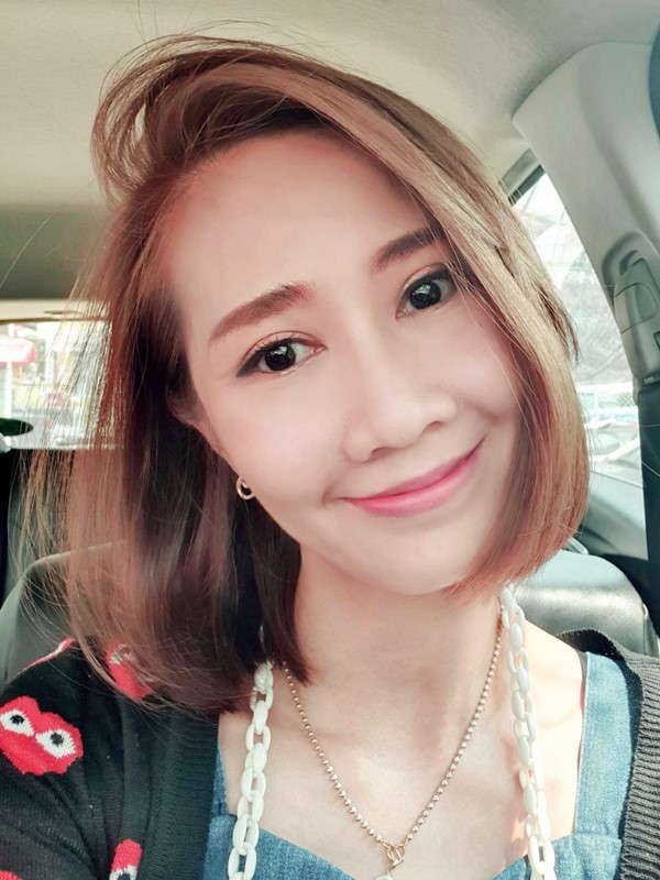 หลังทำตาสองชั้น+เปิดหัวตา 1 เดือน ชั้นตาโค้งสวย ชั้นตาชัดแบบที่ต้องการ หัวตาเปิดกว้าง ทำให้ตาโตได้สัดส่วน ดูสดใส
