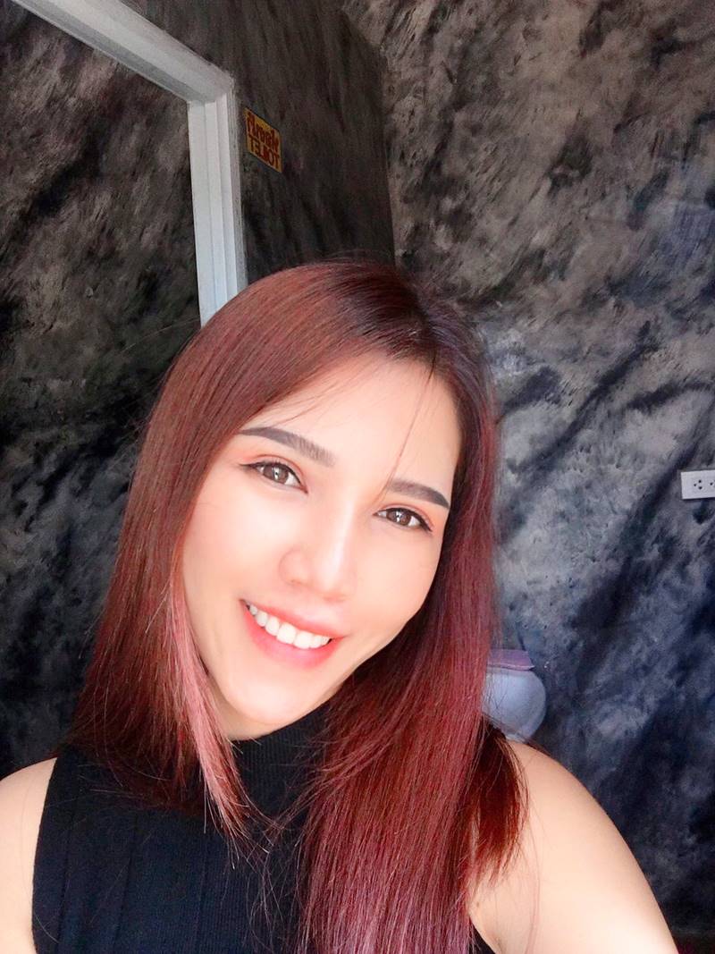 หลังทำตาสองชั้น+เปิดหัวตา 2 เดือน