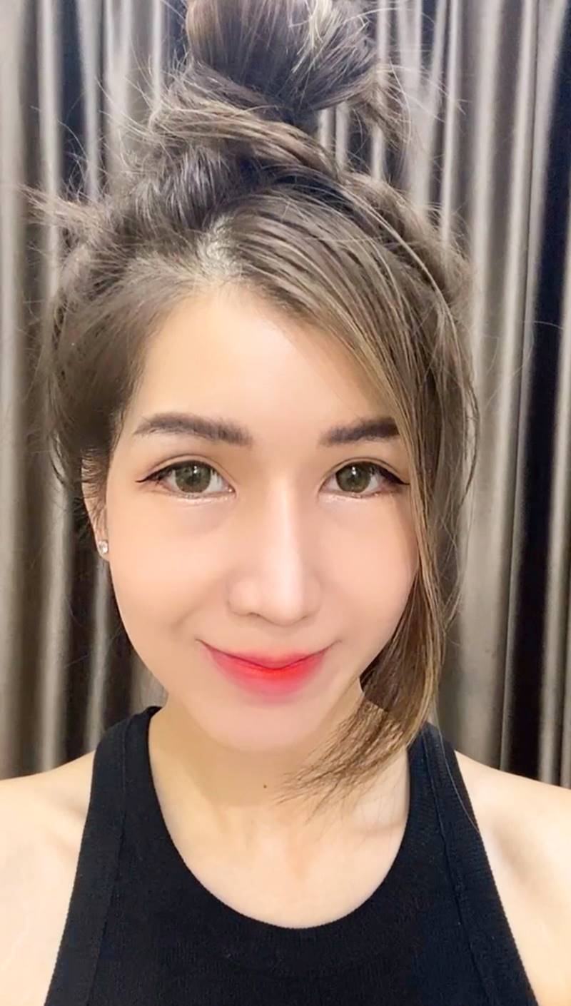 หลังทำตาสองชั้น+เปิดหัวตา 3 เดือน