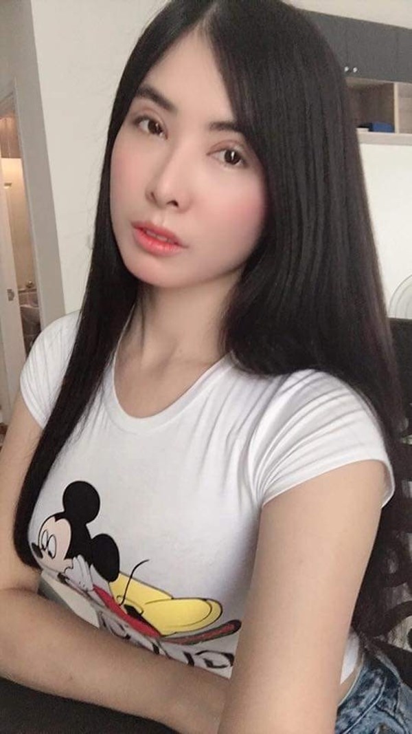 หลังทำตาสองชั้น+เปิดหัวตา 27 วัน ชั้นตาสวย คมชัด และยังเข้าที่ได้อีกเรื่อยๆ