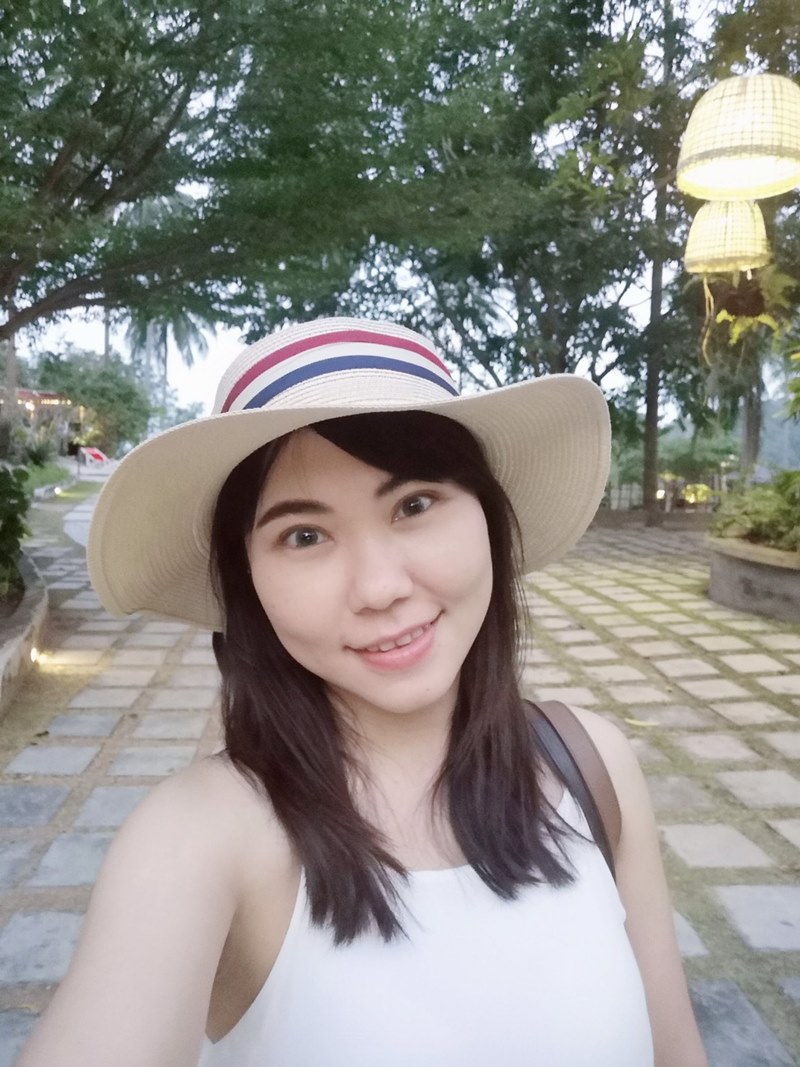 หลังทำตาสองชั้น เปิดหัวตา 1 เดือน ตาหวาน สวยเฉี่ยวมากขึ้น