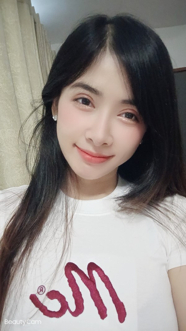 หลังทำตาสองชั้น+เปิดหัวตา 2 ปี 1 เดือน ชั้นตาคมชัด ไม่มีปัญหาตาหลบใน