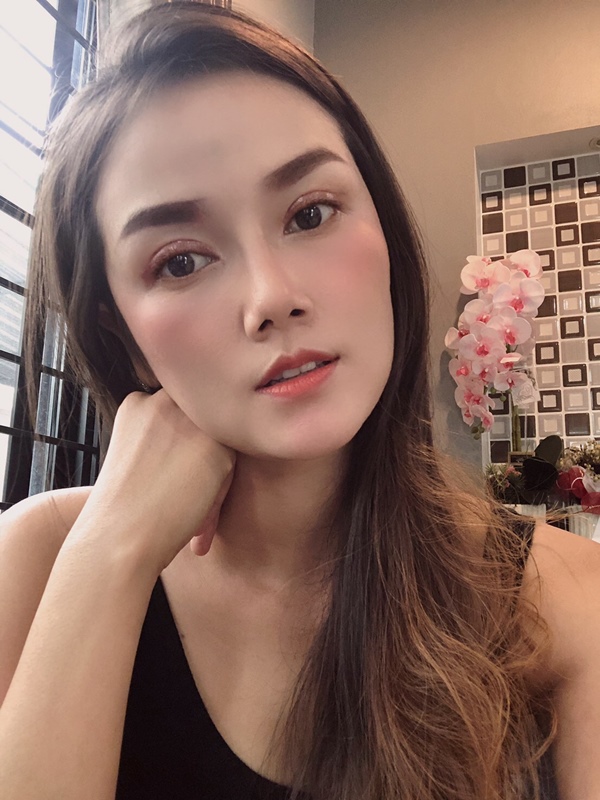หลังศัลยกรรมตาสองชั้น+เปิดหัวตา 12 วัน ชั้นตาพับตามรอยดี