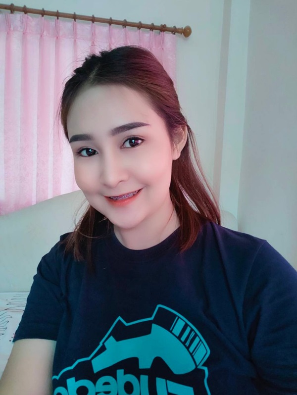 หลังทําตาสองชั้น+เปิดหัวตา 2 เดือน ชั้นตาพับเป็นสองชั้น ดูเป็นธรรมชาติ