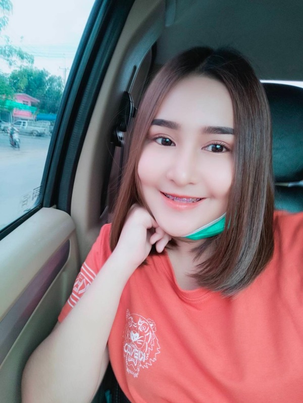 หลังทําตาสองชั้น+เปิดหัวตา 2 เดือน ประมาณ 2 เดือน ตาสวย แผลเนียนกริบ