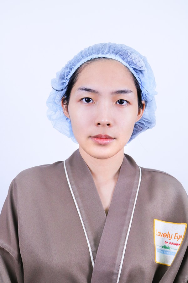 ปัญหาก่อนทำตา ชั้นตาหลบใน ตาไม่เท่ากัน ตาเล็ก ดูไม่สดใส