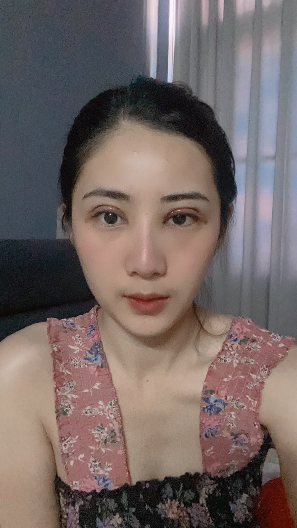 ทำตาสองชั้น เปิดหัวตา 260922 (6).jpg