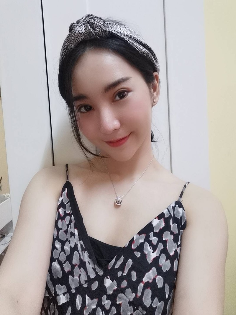 หลังทำตาสองชั้น+เปิดหัวตา 12 วัน ตาสวย ถ่ายเซลฟี่แล้วมั่น