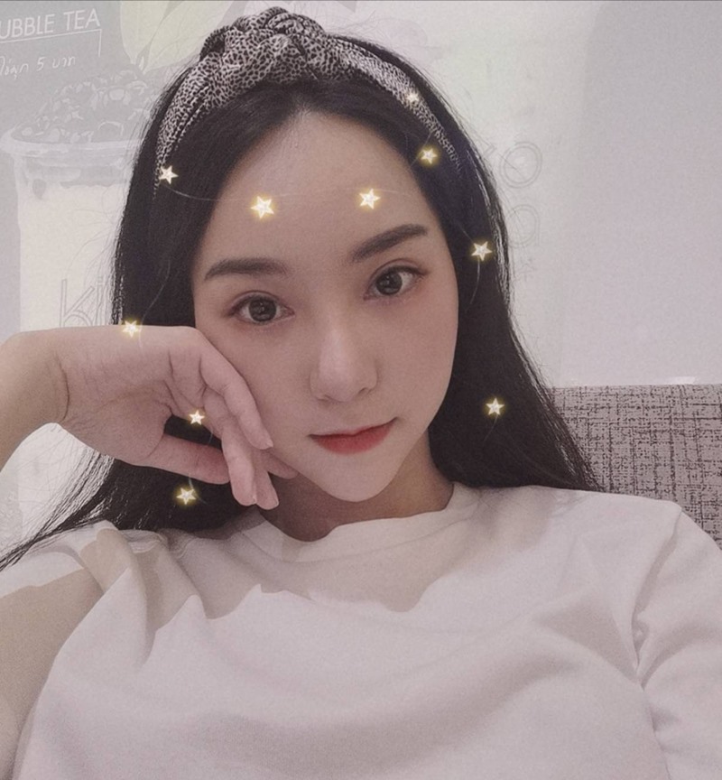 หลังทำตาสองชั้น+เปิดหัวตา 19 วัน ตาโต ไม่มีหนังตาตกแล้ว